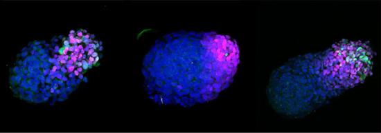 ▲培养24小时、48小时和72小时的人类类原肠胚，蓝色标记了DNA，红色标记神经细胞，绿色标记中胚层细胞（Credit： Naomi Moris）