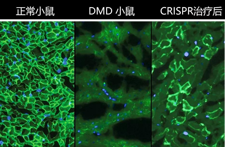 通过基因编辑治疗DMD小鼠实验第一次展示了基因治疗有可能在小老鼠身上成功