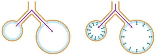 缺少表面活性物质（左）时，小肺泡中的气体会流向大肺泡，有表面活性物质的正常肺泡（右）则能保持平衡 | 图源：bioninja