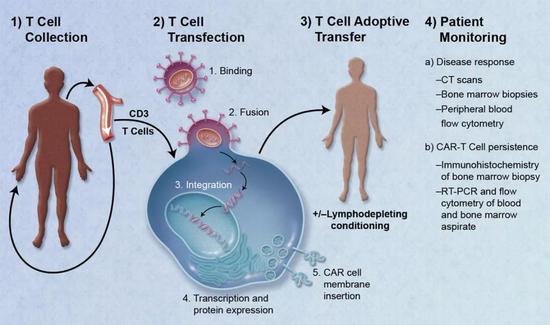 ▲CAR-T疗法是近年来的抗癌一大突破（图片来源：Caron A。 Jacobson and Jerome Ritz [Public domain]）