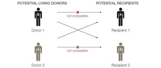 　交换配对示意图，两对无法匹配的供体和受体间交换移植，但这种巧合发生的机会并不多 | Stanford Health Care