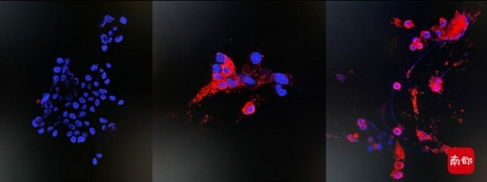 免疫荧光图像检测变种病毒的NP蛋白未感染组、24小时感染组、48小时感染组（左、中、右）。香港大学供图