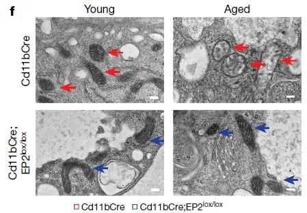电镜图片显示，老年小鼠的巨噬细胞中，负责能量生产的线粒体（箭头所示）在数量和密度上都与年轻小鼠不同，并且这种异常与细胞的EP2受体有关