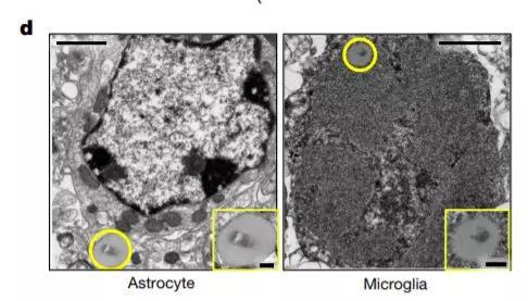 ▲星形胶质细胞与小胶质细胞出现了衰老（图片来源：参考资料[1]）