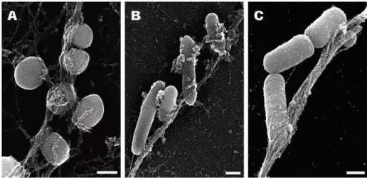 NET捕获的细菌，A、B、C分别是金黄色葡萄球菌、伤寒沙门氏菌和痢疾志贺菌