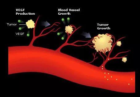 肿瘤会诱导血管生成，偷走正常组织的能量