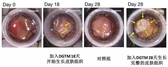 伤口修复:不用担心皮肤受伤?伤口细胞变身干细胞完美修复伤口