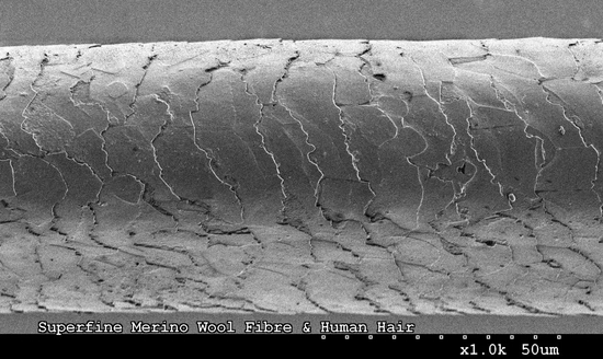 电子显微镜下的头发 
