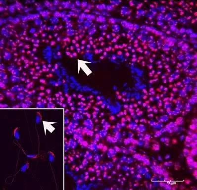 服用尼古丁小鼠的后代出现特殊基因表观遗传修饰的免疫荧光标记。图片来源文献。
