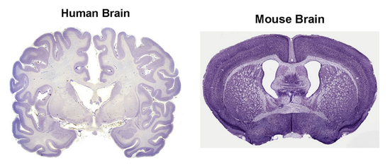 人类和小鼠在大脑结构上有巨大差异(图片来源:MSU Human Brain Atlas, Brainmaps.org)