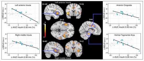  胰岛素反应与大脑对甜味的感知成反比