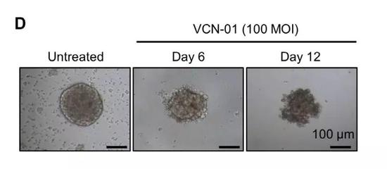 ▲体外实验中，这种病毒能有效杀死RB1基因失活的细胞（图片来源：参考资料[1]）