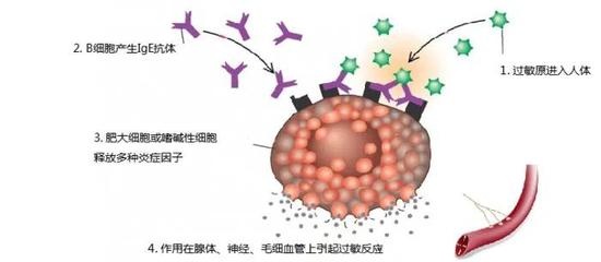 鼻炎是最常见的过敏反应