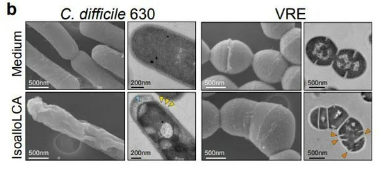电子显微镜下可以看到，isoalloLCA引起了艰难梭菌和粪肠球菌（VRE）变形，最终杀死了这些病原体