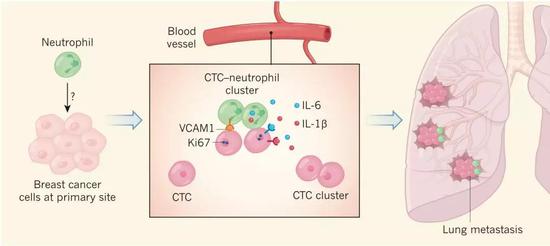 中性粒细胞与CTC结合促进癌细胞转移的过程示意图