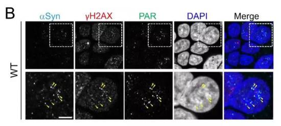  ▲α-突触核蛋白与不少负责DNA修复的元件有着共同的定位（图片来源：参考资料[1]）