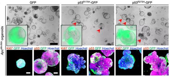 类器官研究证实了突变型p53超强的抑癌能力