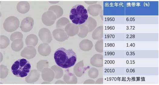 ATL患者血样中特有的“花细胞”（左），和日本长崎县孕妇中的携带者比例（右）
