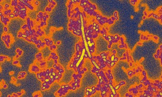 ▲肠道中存在许多拟杆菌，图中有5种混合在一起（图片来源：Kevin Cutler/Mougous Lab/UW/HHMI）