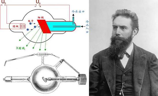 伦琴发现x线图片
