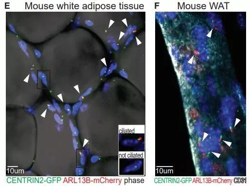 ▲如箭头所示，小鼠白色脂肪组织中的大部分前体细胞有原纤毛结构（图片来源：参考资料[1]）