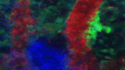 在湍流中血小板从巨核细胞上脱落图中绿色的是血小板和巨核细胞，红色是血流，蓝色是细胞核
