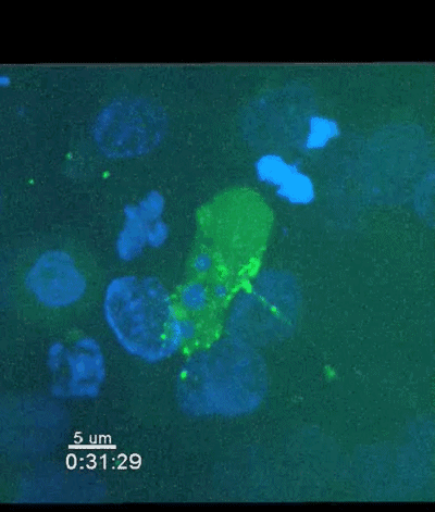 可以清晰看见病毒学突触穿过蓝色的上皮细胞