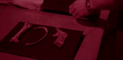 四乙基铅:这位孤独先知能查明每种毒物仍无法阻止美国人作死 实验组照片里骨头的星星白点,便是最关键的证据。