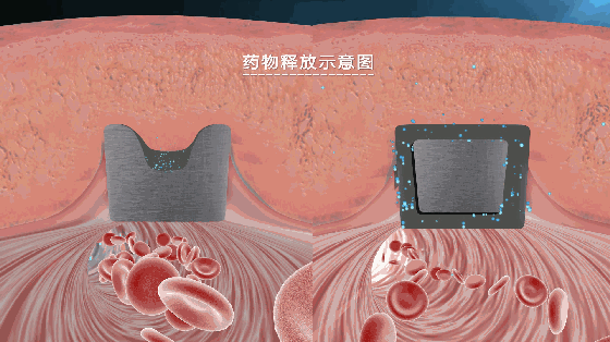 各种技术革新，都是为了精准给药~