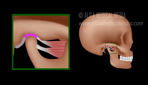 颞下颌关节（TMJ），头骨的左右侧各有一处（图片来源：Alila Medical Media）