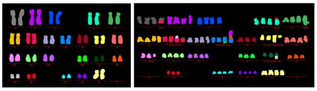 左图为正在进行自噬反应的细胞中的23对染色体，看起来呈正常的健康状态，没有结构和数量畸变（每种颜色代表一对染色体）。右图为端粒损伤危机中抑制了自噬反应的细胞染色体，表现出结构和数量上的畸变