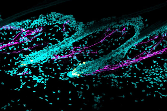 本图展示了黑色素干细胞（黄色）周围的交感神经（品红色）。| 来源：Bing Zhang和许雅捷