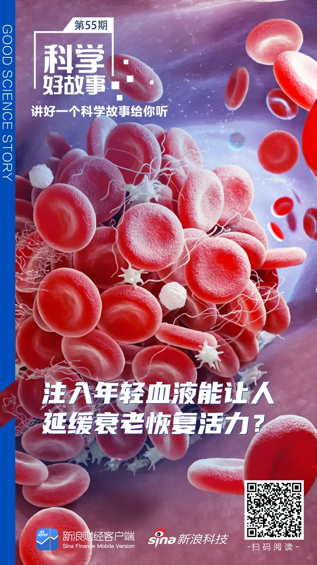 科学好故事 注入年轻血液能让人延缓衰老恢复活力 斯坦福大学 血液 年轻 新浪科技 新浪网 科学好故事 注入年轻血液能让人延缓衰老恢复活力 斯坦福大学 血液 年轻 新浪科技 新浪网