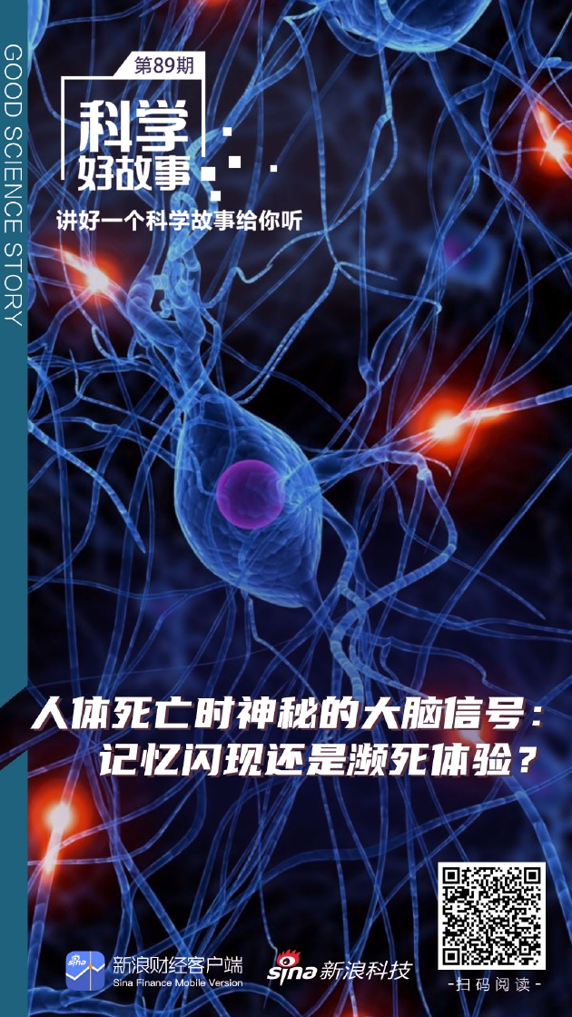 科学好故事|人体死亡时神秘大脑信号：记忆闪现还是濒死体验？