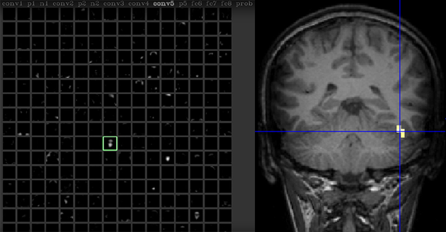 图为深度神经网络中的单个神经元（由绿框标出）对尤辛斯基的面部图像做出反应，就像人脑的某个脑区（标为黄色）也会对面部图像做出反应一样。