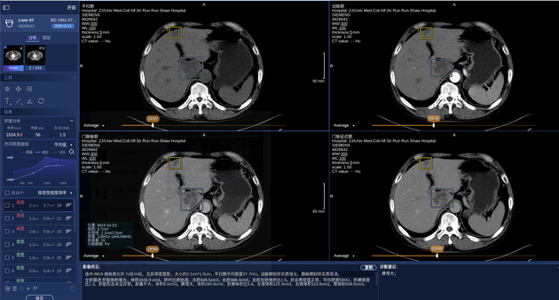 商汤科技SenseCare®️肝脏CT智能临床解决方案产品界面