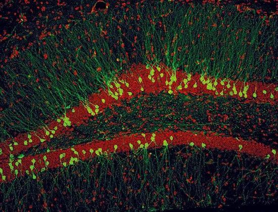 研新的神经元（绿色）整合到海马体（红色带状）中会让原有记忆退化。 　　来源： Jagroop Dhaliwal