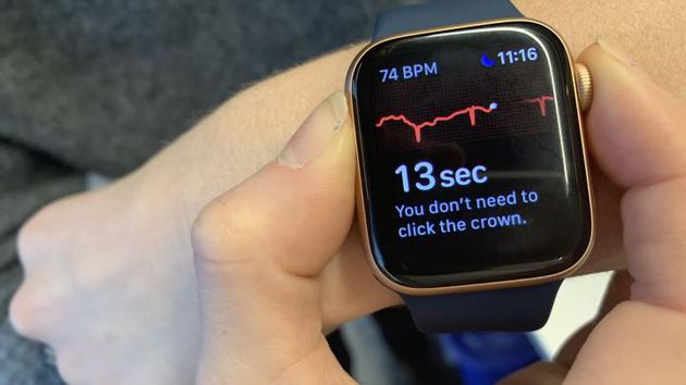 ECG功能浅析：苹果Apple Watch的心电图功能如何使用