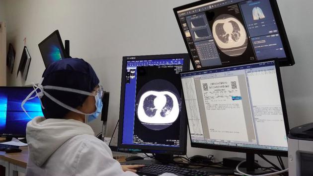 医生应用新冠肺炎CT影像系统，据钛媒体了解，在疫情结束之前，依图医疗愿意将新冠肺炎影像产品对定点收治医院免费升级部署。