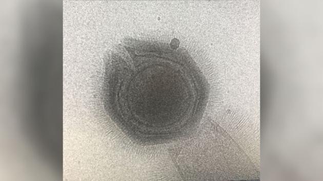 研究小组发现有3种情况导致了巨型病毒的星门开启：低pH值、高盐浓度和100摄氏度以上的高温条件。