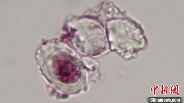 尾羽龙腿骨软骨细胞的显微照片。其中一个细胞中还有经过染色而显示出的细胞核，以及暗色的细丝状染色质。图片来源：中新网