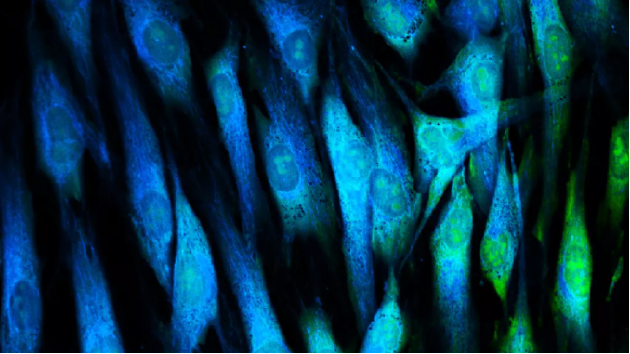 图中是使用荧光染料标记的成纤维细胞(皮肤细胞)，目前，英国研究人员最新研制一种方法，可以逆转皮肤细胞的衰老进程，使生物钟倒退大约30年。