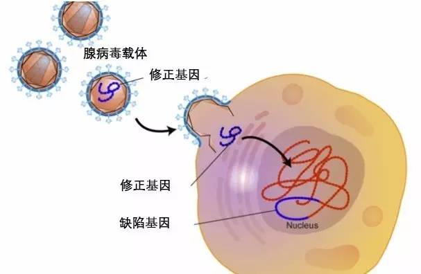 基因疗法通常采用病毒来改变或替换某种引发疾病的基因,但由于其可能