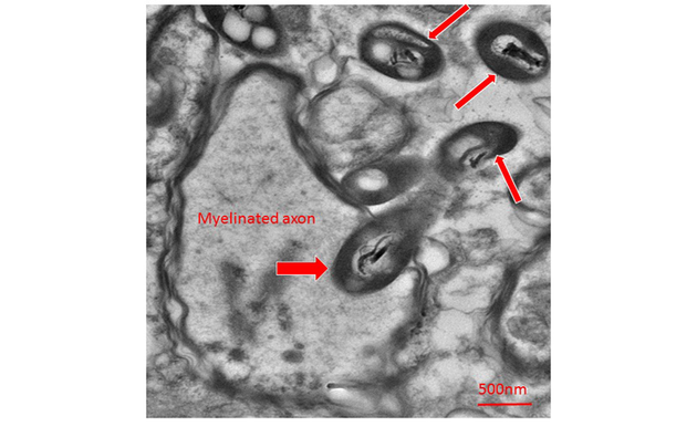 电子显微镜下人体大脑中轴突旁边的细菌（红色箭头）。最左边的那个细菌似乎正在钻入轴突内部。