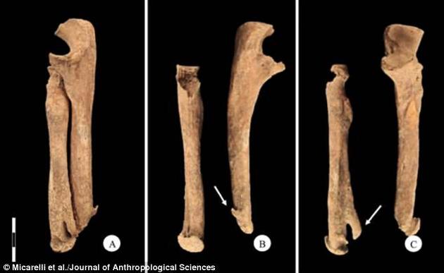 图为这位无名武士的前臂骨头。A为整体前视图，B中箭头所指为尺骨，C中箭头所指为桡骨。这名武士去世时可能正值40多岁。他的一只手被某种钝器切除，断骨处接上了一柄刀子。