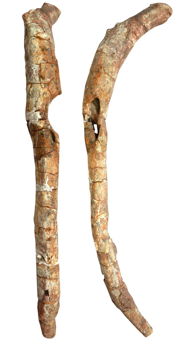 一根肋骨的奇妙故事