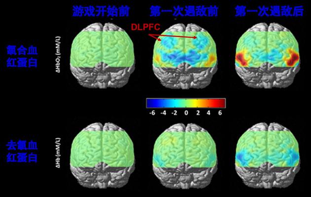 大学生玩家玩《英雄联盟》时大脑的实时功能活动监测结果。跟游戏开始前（左图）相比，游戏开始后双侧背外侧前额叶（DLPFC）中的氧和血红蛋白（HbO2）水平显著下降（中图），提示脑区的功能可能受到了抑制。遇到敌人并进入战斗后有所恢复（右图）