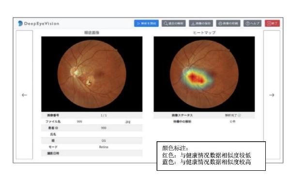 DeepEyeVision for RetinaStation的画面示意图