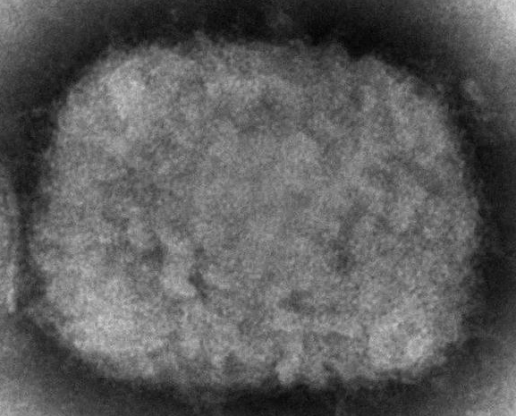 电子显微镜图像显示猴痘病毒