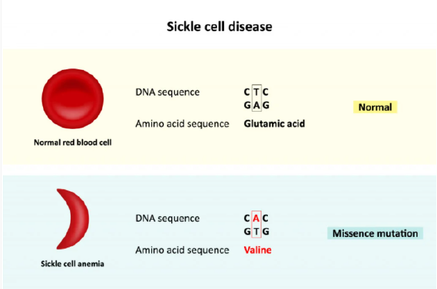 β-球蛋白基因的突变会导致镰刀型红血球疾病